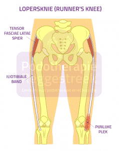 Lopersknie runners knee Podotherapie Reggestreek Rijssen https://www.podotherapiereggestreek.pro/wp-content/uploads/2019/01/lopersknie-runners-knee-podotherapie-reggestreek-rijssen.png